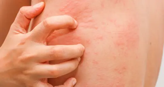 The Day Clinic - Allergies