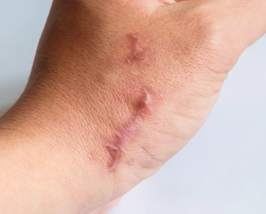 Steroid Injection Results - The Day Clinic
