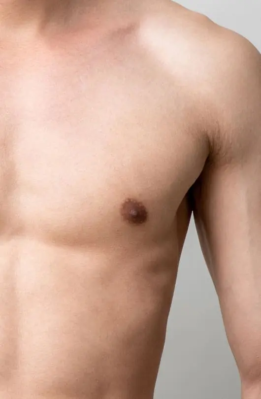 Inverted Nipples