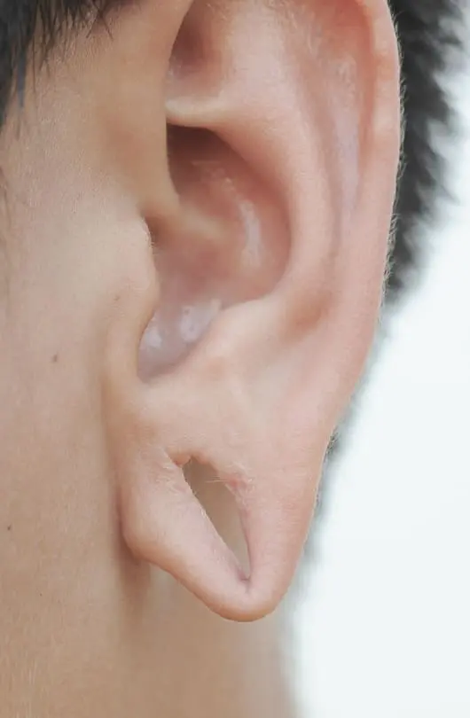 Split Earlobes