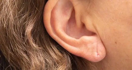 Split Earlobe Surgery