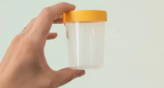 The Day Clinic - Urine Test