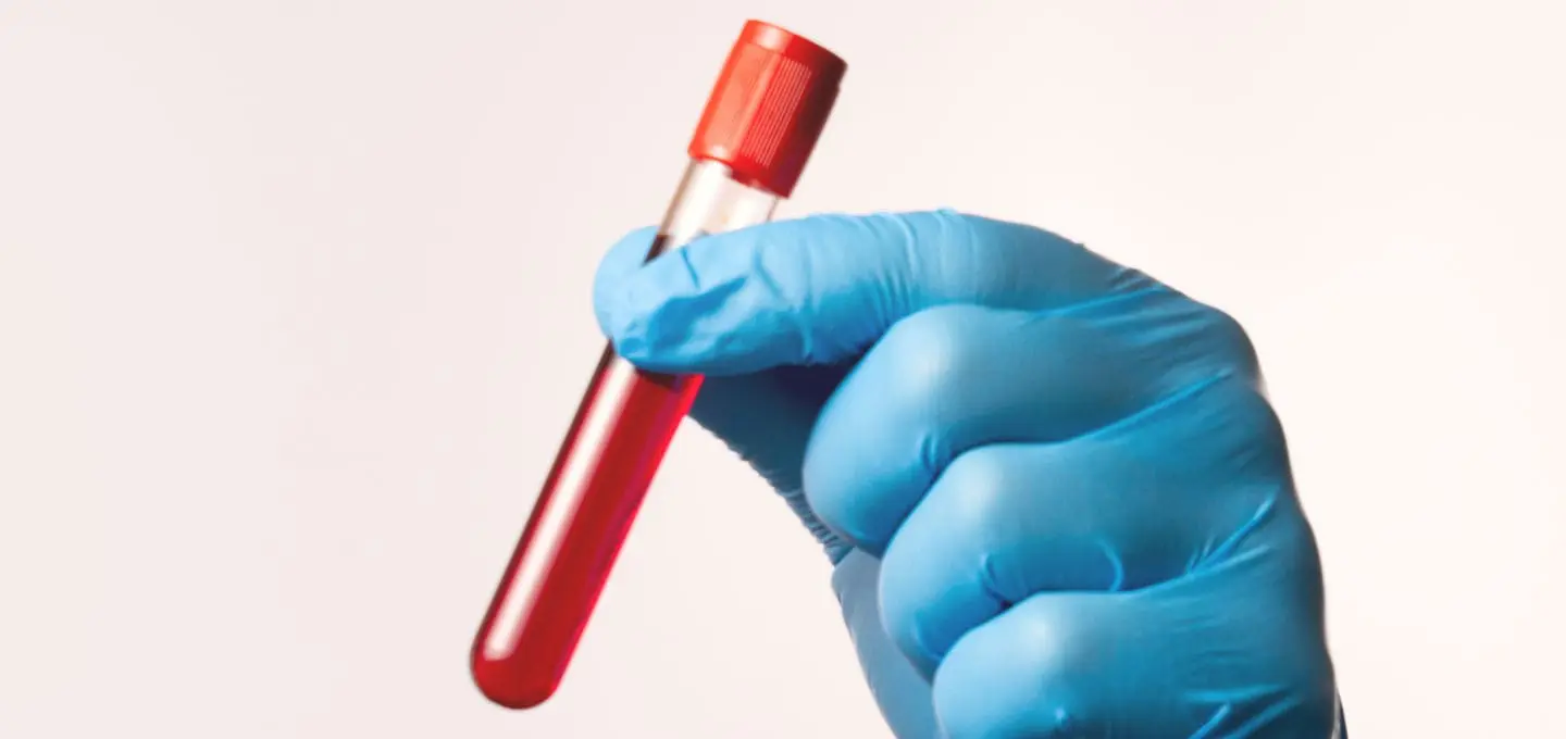 The Day Clinic - Urology - Blood Tests