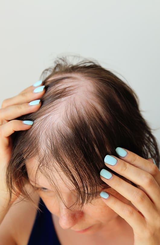 The Day Clinic - Hair Loss and Hair Disorders