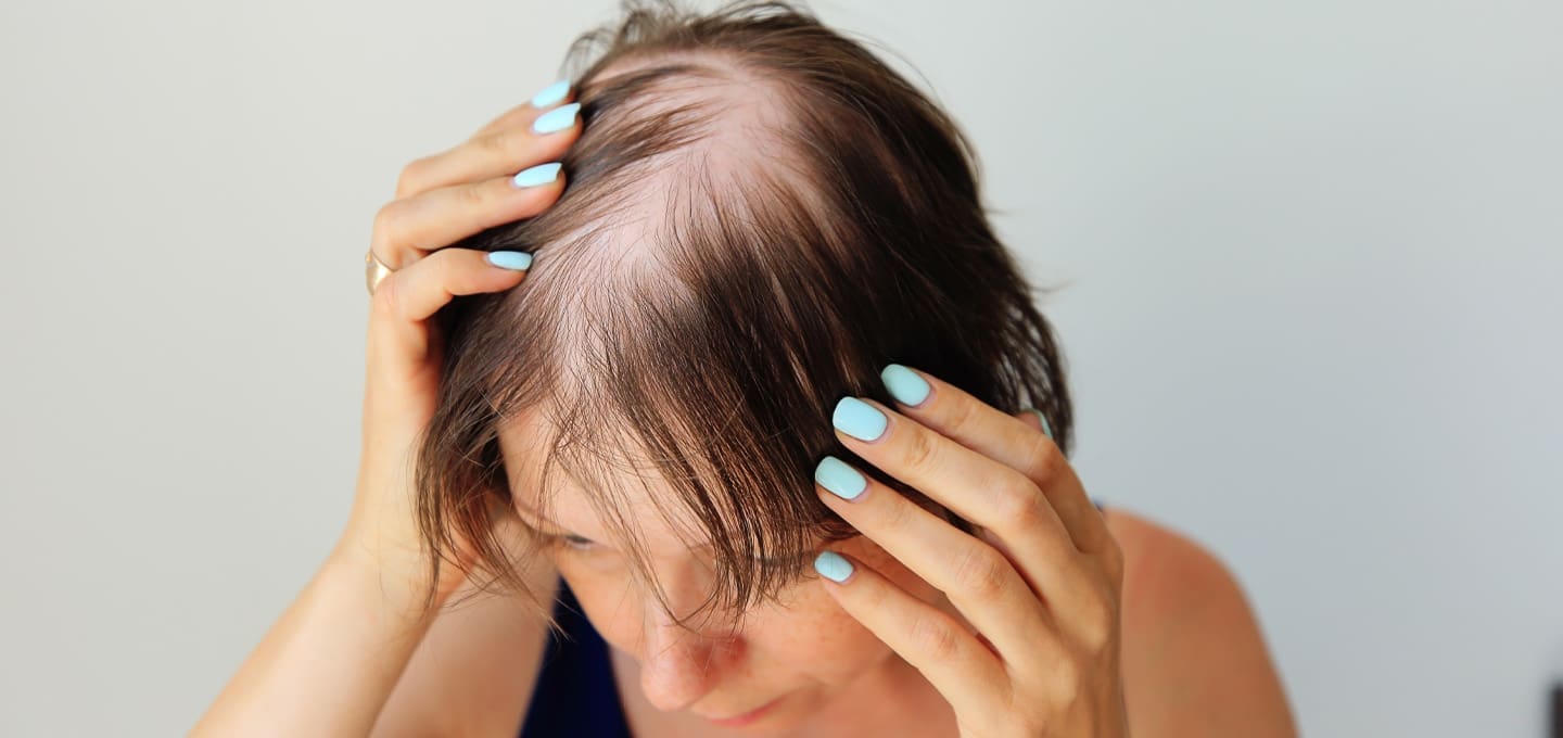 The Day Clinic - Hair Loss and Hair Disorders