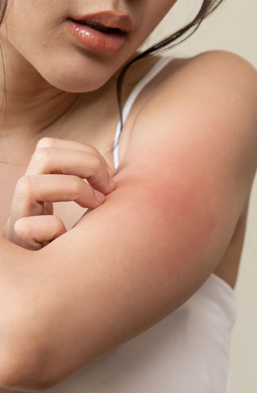 The Day Clinic - Rashes