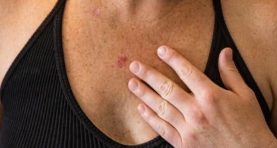 The Day Clinic - Sun Damaged Skin