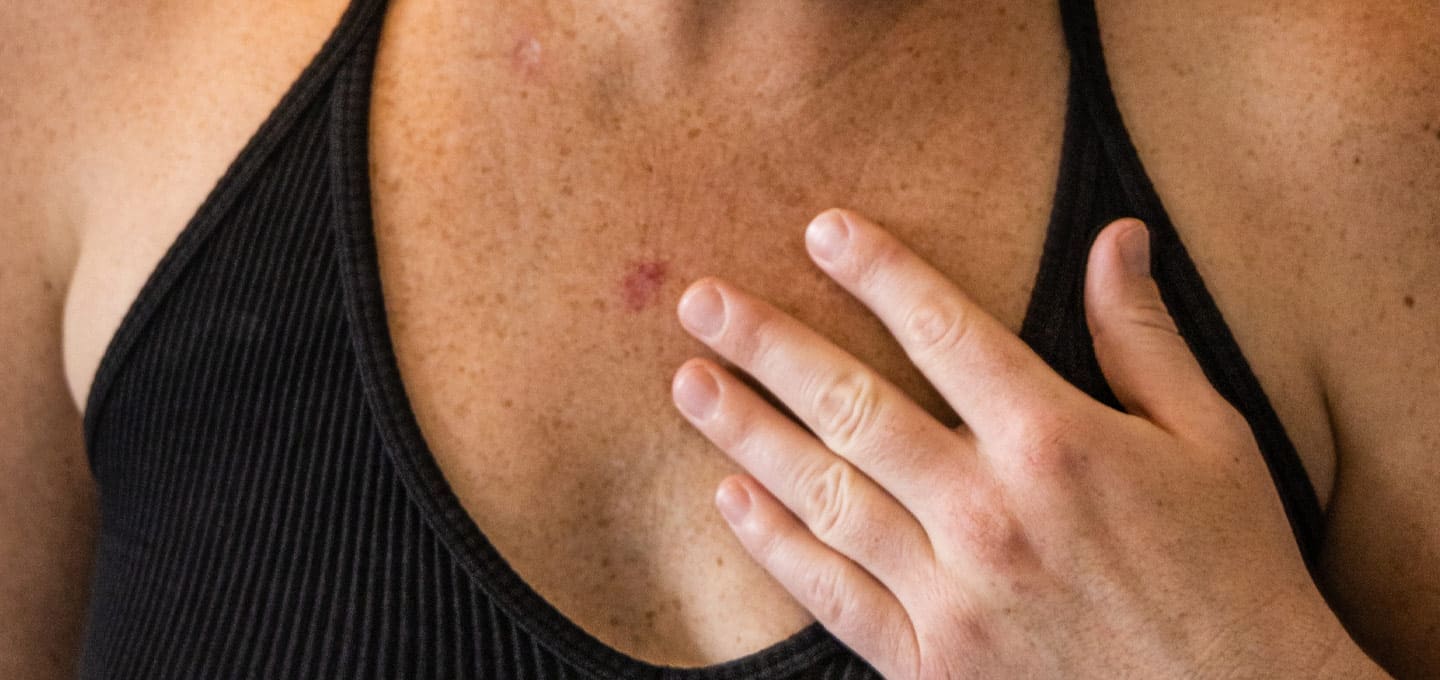 The Day Clinic - Sun Damaged Skin