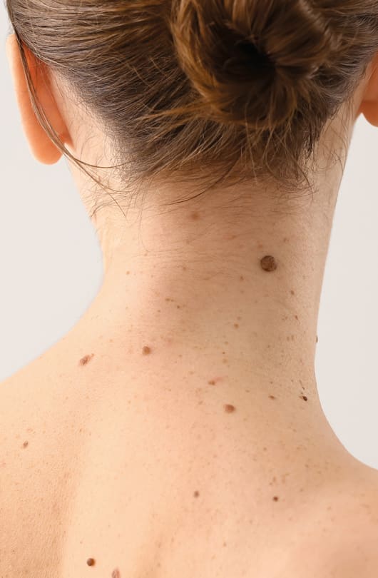 Skin Treatment at The Day Clinic