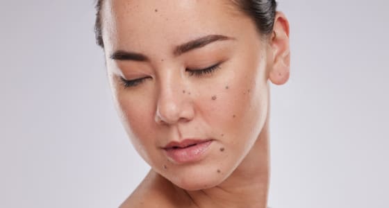 Skin Treatments - The Day Clinic