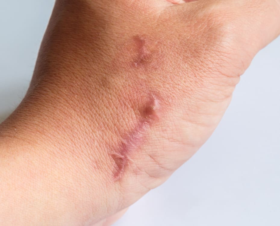 Steroid Injection Results - The Day Clinic