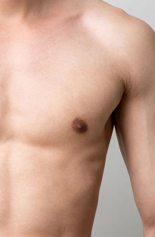 Inverted Nipples