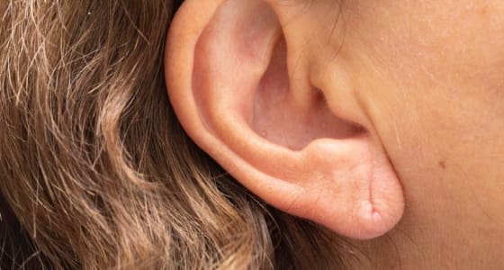 Split Earlobe Surgery