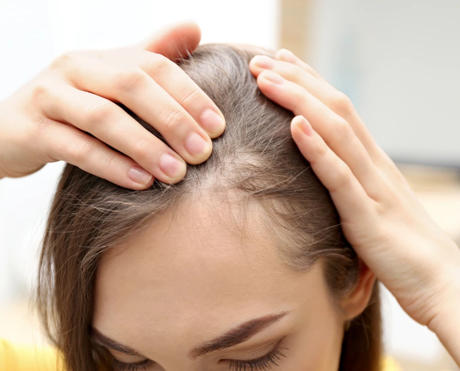 female hair loss Cambridge patient