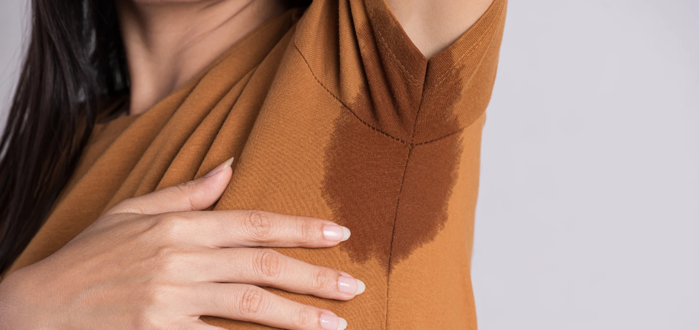 Cambridge excessive sweating patient