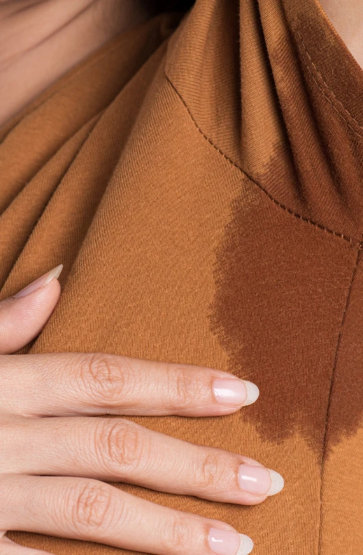 Cambridge excessive sweating patient