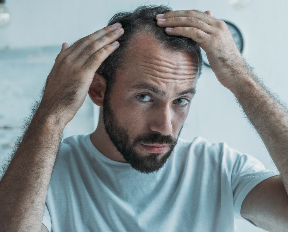 hair loss Cambridge aftercare patient image