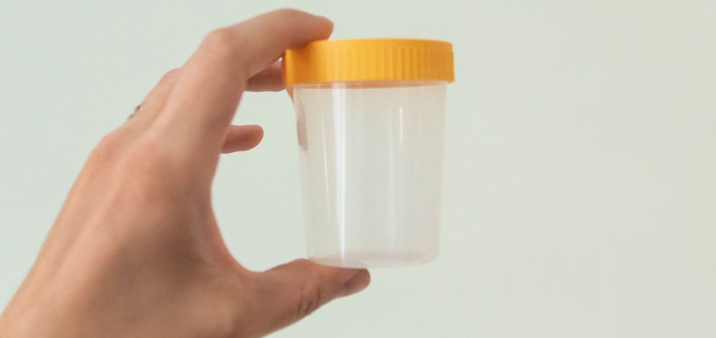 The Day Clinic - Urine Test