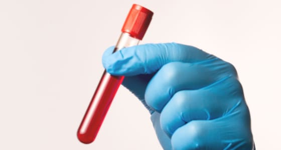 The Day Clinic - Urology - Blood Tests